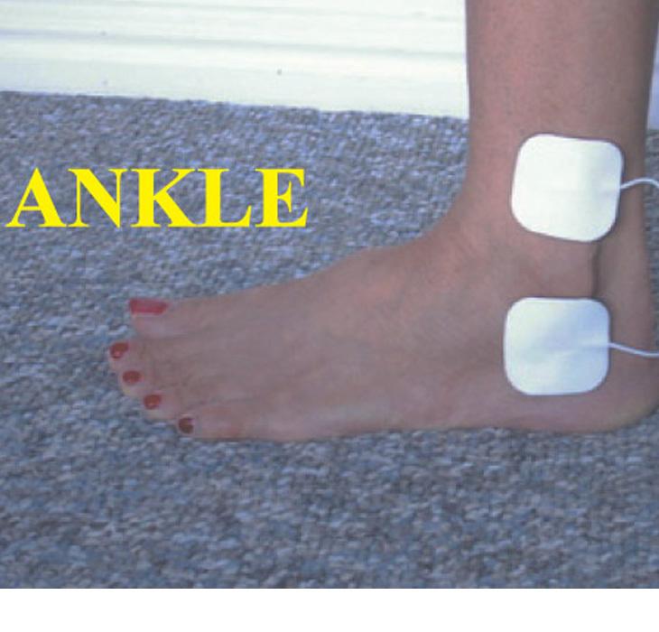 Electrode Pads on Ankle